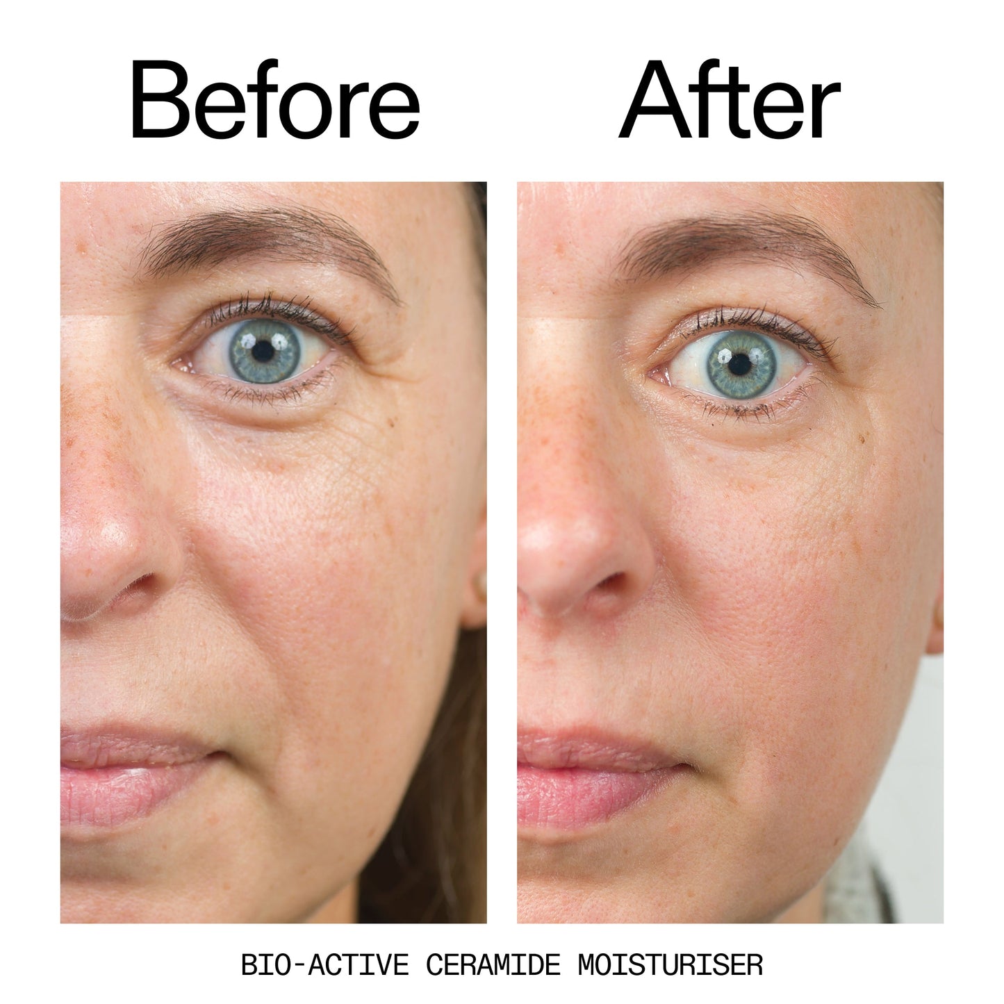barrier-boosting-trio-k7 Bio-Active_Before_After_2000x2000_600947b4-e8c5-425a-9155-fc15bc83aa12.jpg