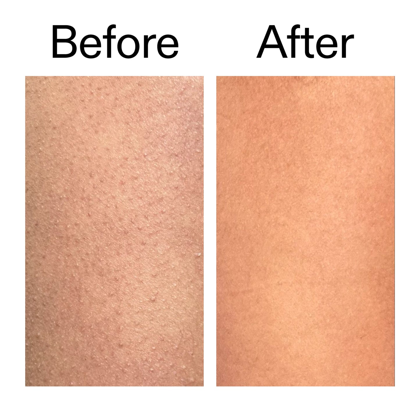 glycolic-acid-exfoliating-body-stick-duo-y2 Glycolic_Body_Stick_B_A_2000x2000_6e6e6b4d-5bd7-43c0-aeed-4d66788e8995.jpg