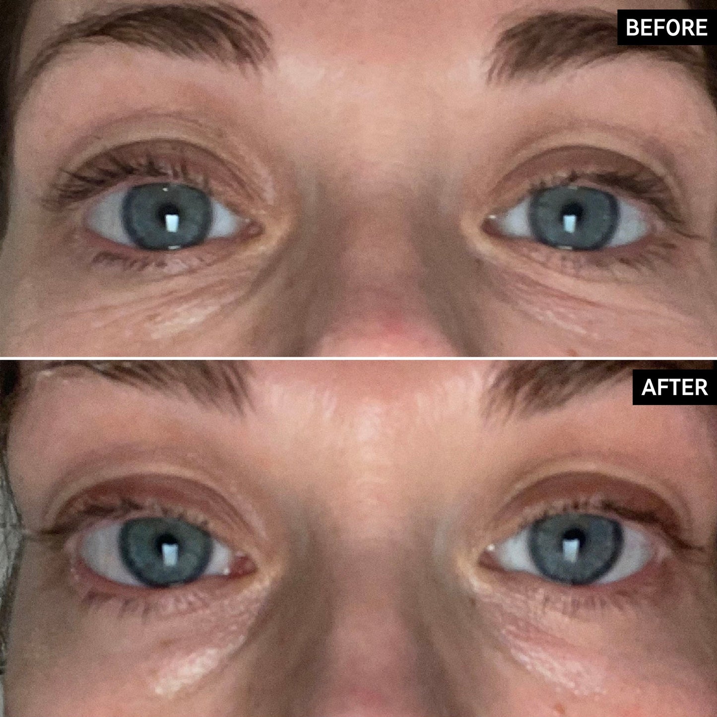 retinol-eye-cream-g1 SITE-UGCBAsApril_Nicole_B_A_PPage_2000x2000_1.jpg