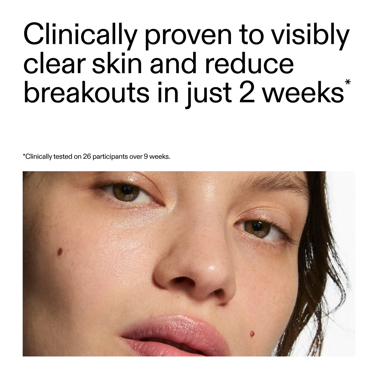 360-acne-clearing-duo-t2 360_Serum_Key_Claim.png