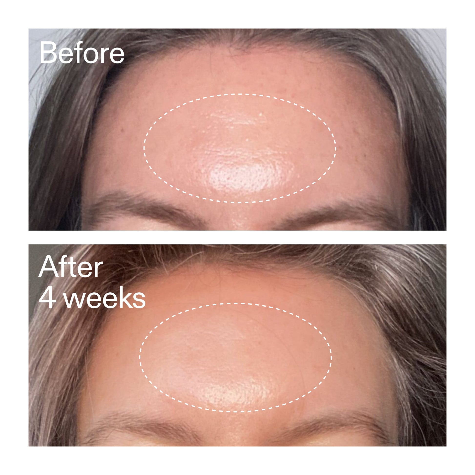 advanced-0-2-retinal-serum-duo-f1 AdvancedRetinal_BeforeAfter1_2000x2000_4e9c798a-f30e-45b8-a34a-7c4740f2f2cb.jpg