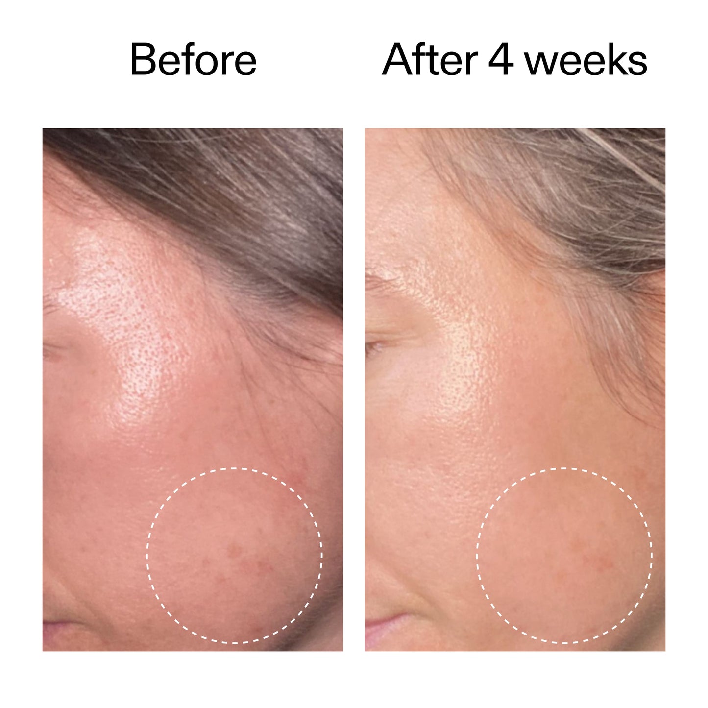 advanced-0-2-retinal-serum-e9 AdvancedRetinal_BeforeAfter2__2000x2000_62fb16bb-77ae-4d63-8500-88dbf847f4b9.jpg
