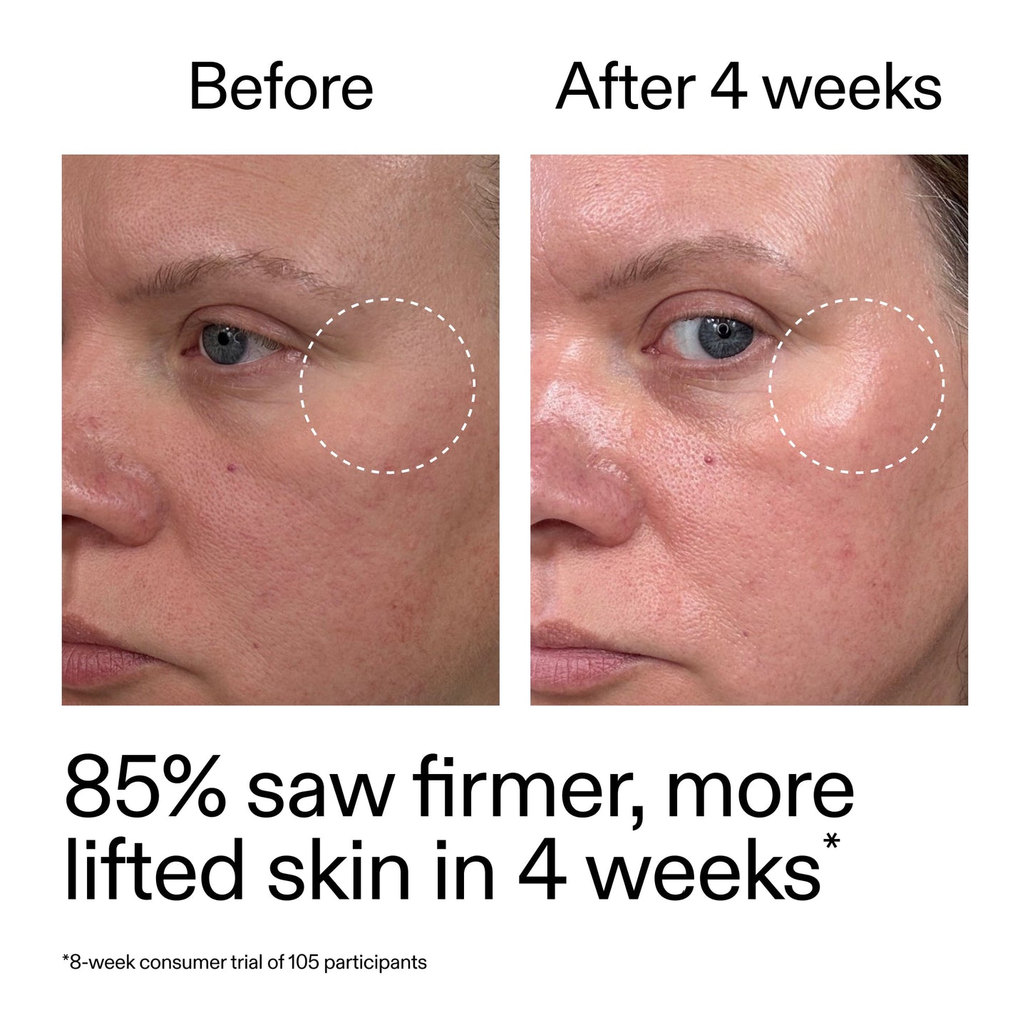 advanced-0-2-retinal-serum-e9 AdvancedRetinal_BeforeAfter_Claim1_2000x2000_bcc385c4-5e73-4f1e-aba8-64267937d0d3.jpg