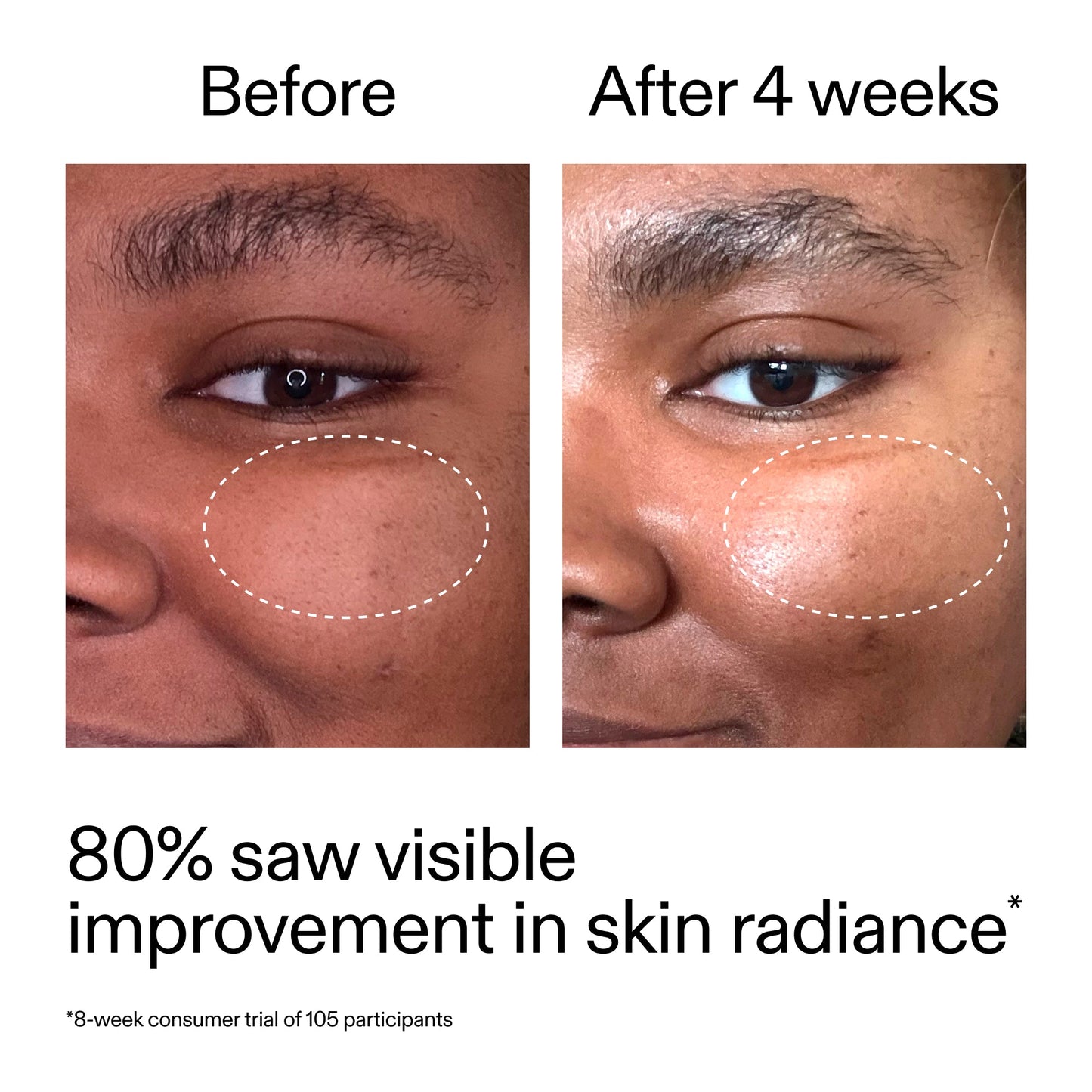 advanced-0-2-retinal-serum-duo-f1 AdvancedRetinal_BeforeAfter_Claim2_2000x2000_681b621d-8d44-4d44-9a40-89244f9b2e53.jpg