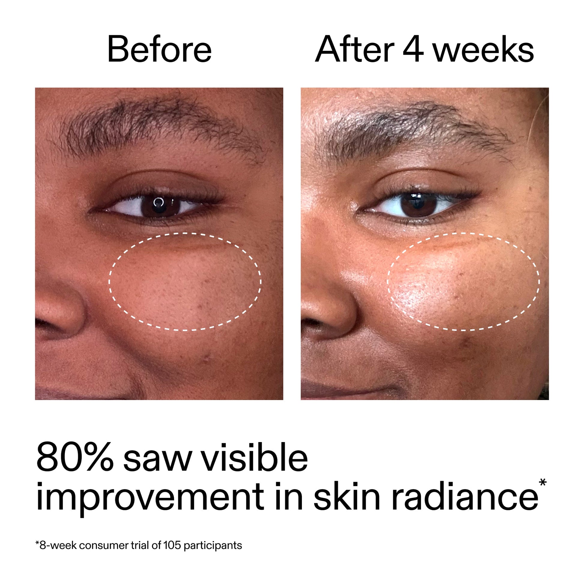 advanced-0-2-retinal-serum-duo-f1 AdvancedRetinal_BeforeAfter_Claim2_2000x2000_681b621d-8d44-4d44-9a40-89244f9b2e53.jpg