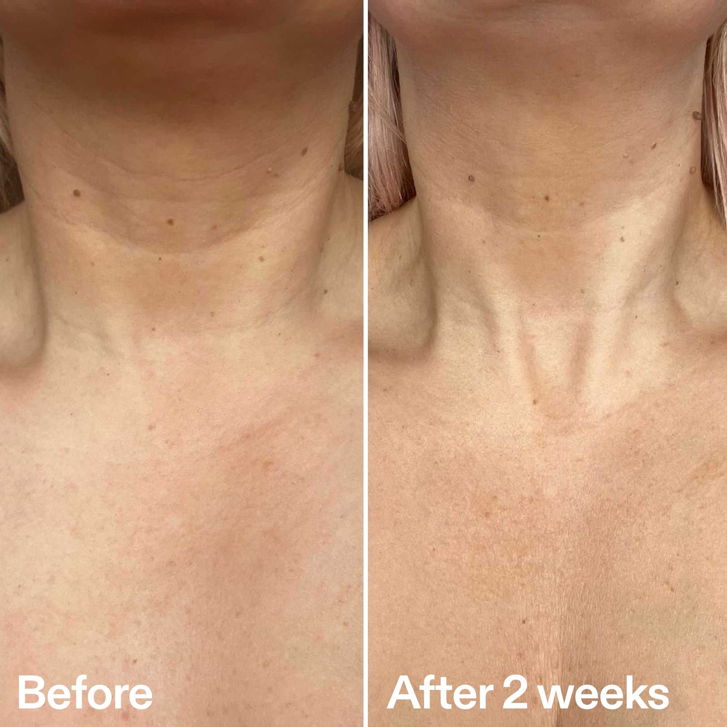 bio-active-neck-lift-stick-o5 B_A_2.jpg