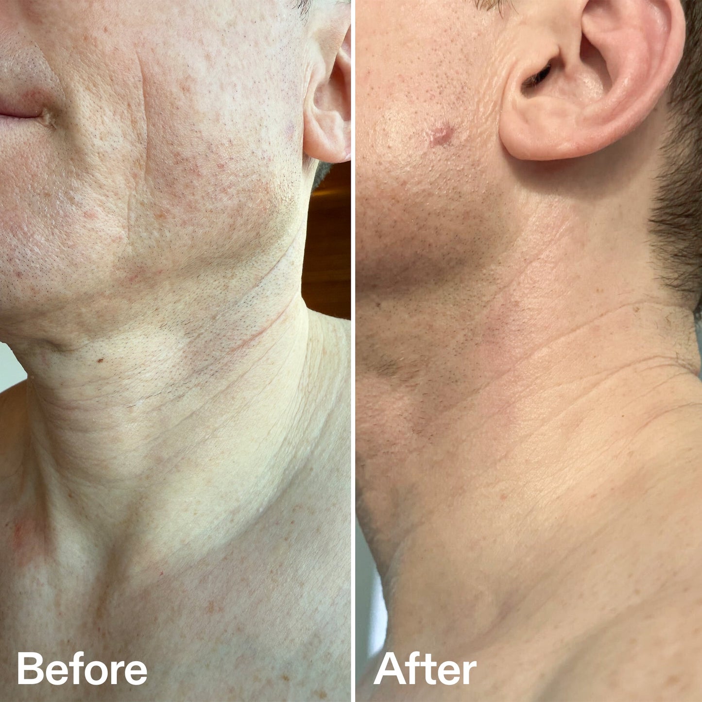 bio-active-neck-lift-stick-o5 B_A_afa2743e-b8e2-4504-92f4-e281cb6cf759.jpg