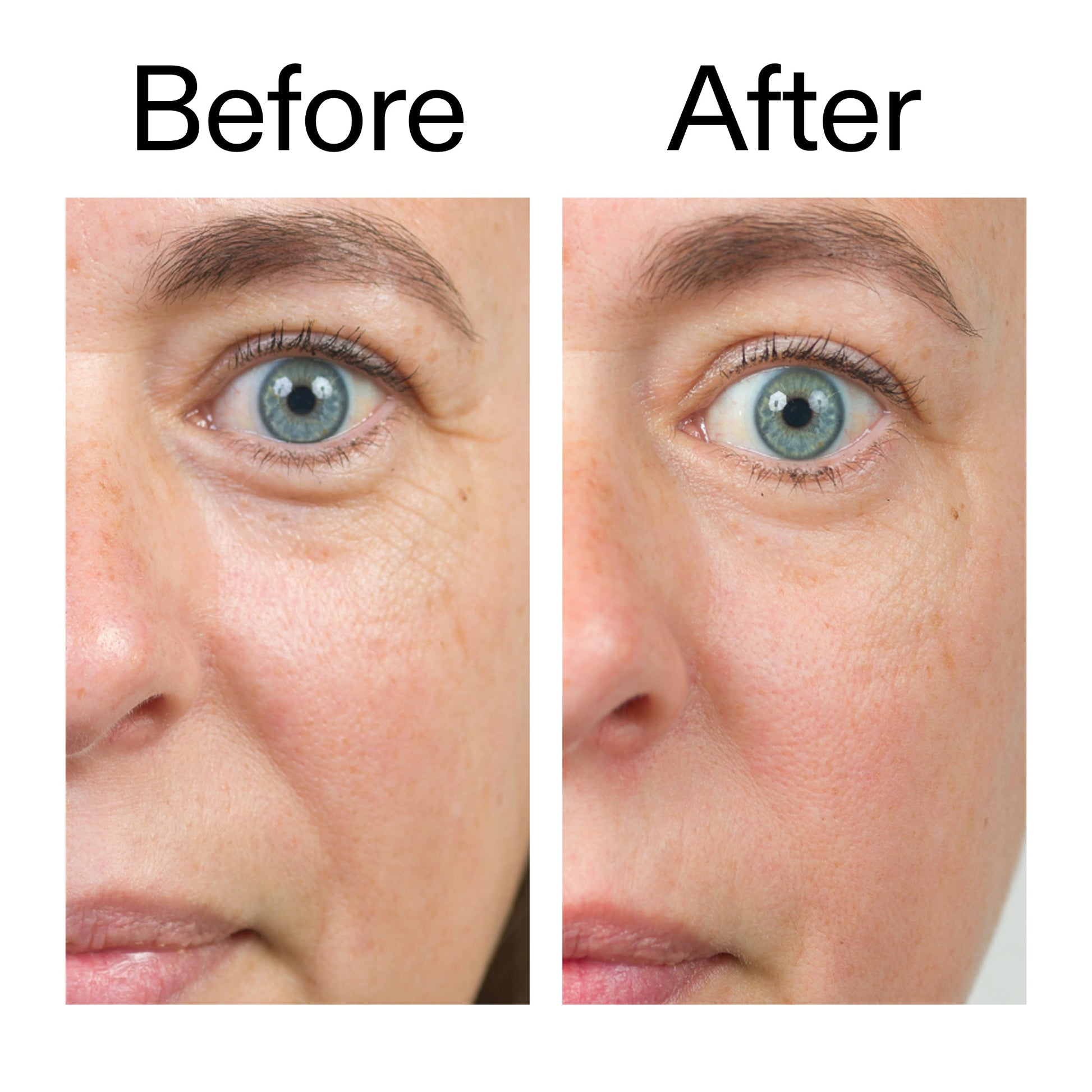 bio-active-ceramide-moisturizer-w1 Bio-Active_Before_After_2000x2000_566e5a9e-135e-417a-8242-b44e5fa35463.jpg