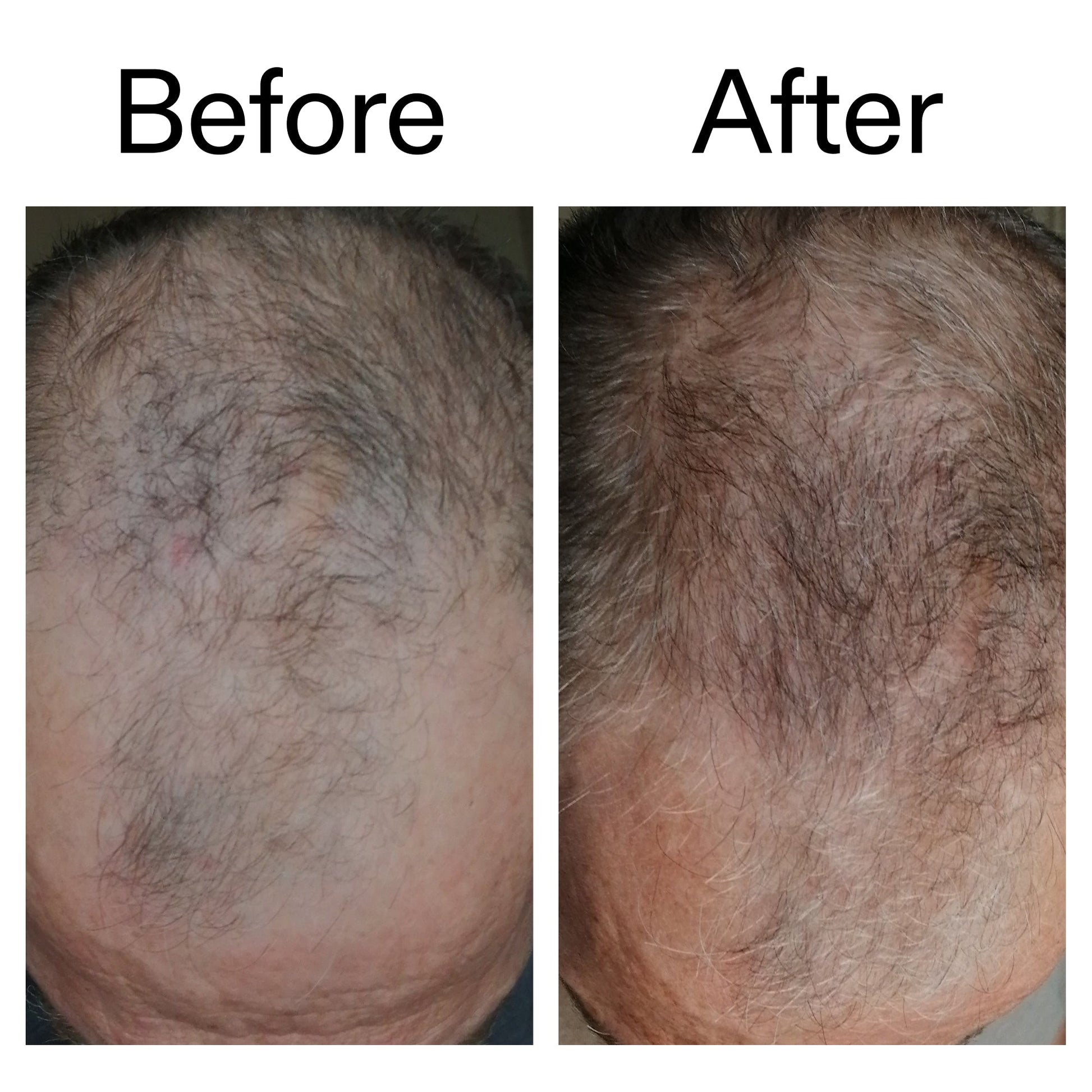 3-month-hair-growth-trio-v5 Caffeine_Scalp_Treatment_B_A_Ppage_2000_x_2000.jpg