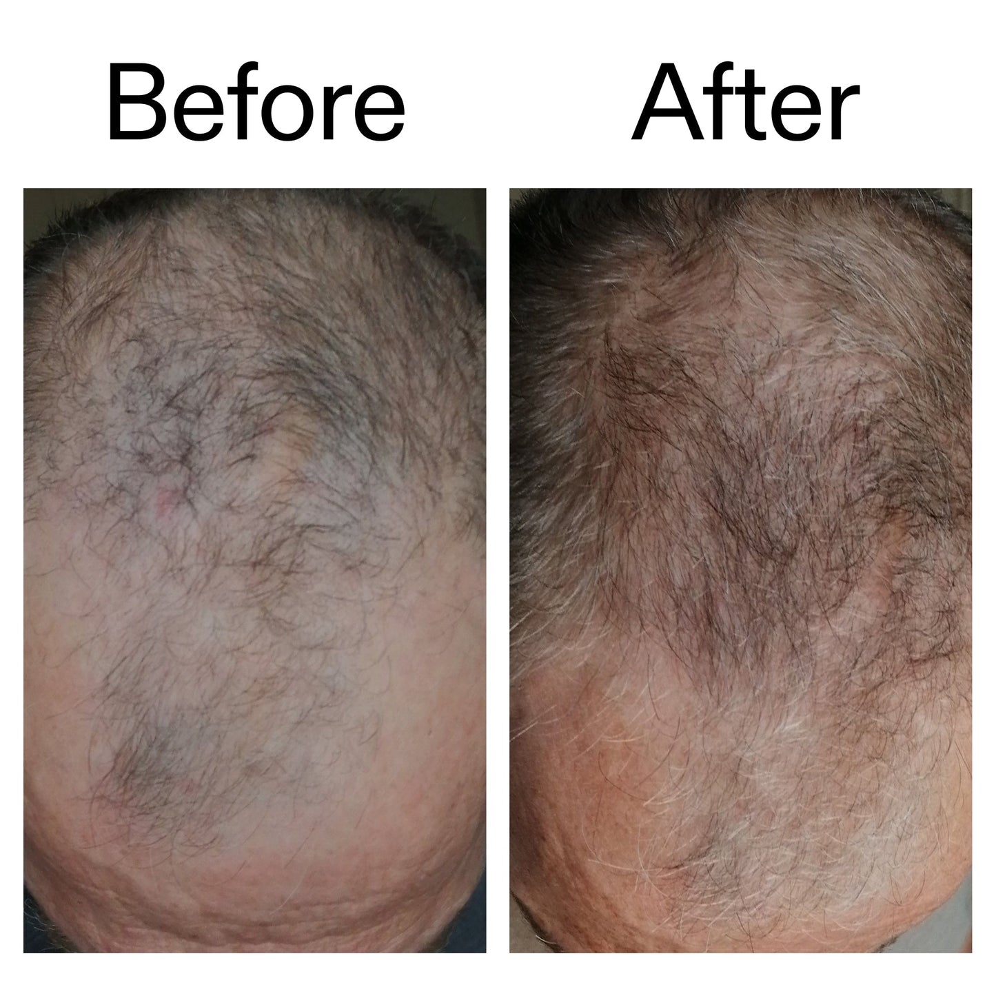 caffeine-stimulating-scalp-treatment-r4 Caffeine_Scalp_Treatment_B_A_Ppage_2000_x_2000.jpg