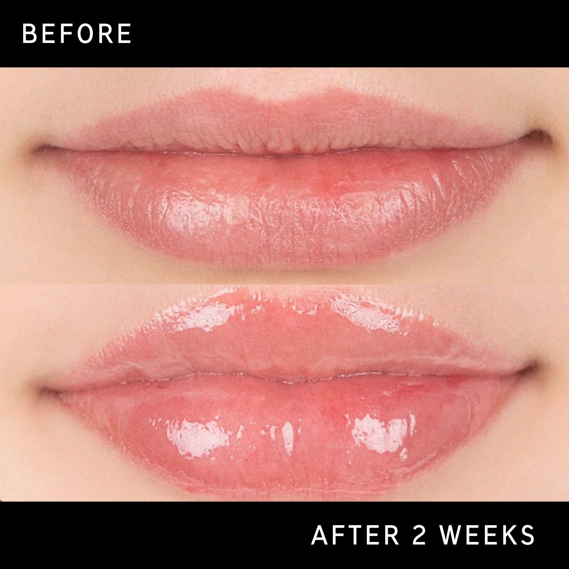 lip-plumping-duo-r7 DTC-Top15_Amends_Tripeptide-Lip_B_A.jpg