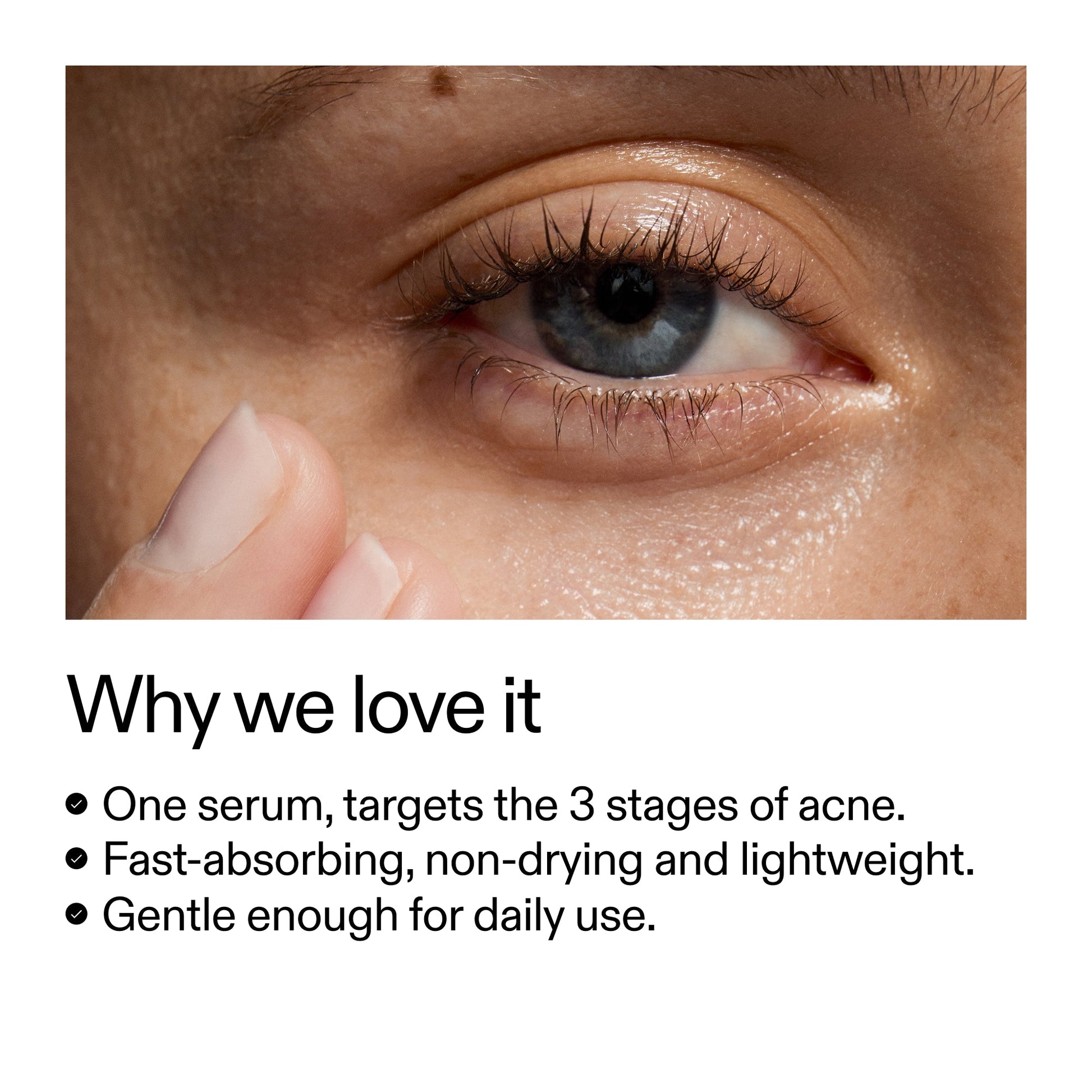 360-acne-clearing-serum-h2 Dioic_Whyweloveit_2000x2000_175aafd3-0cbe-403a-b317-a8362881bfe2.jpg