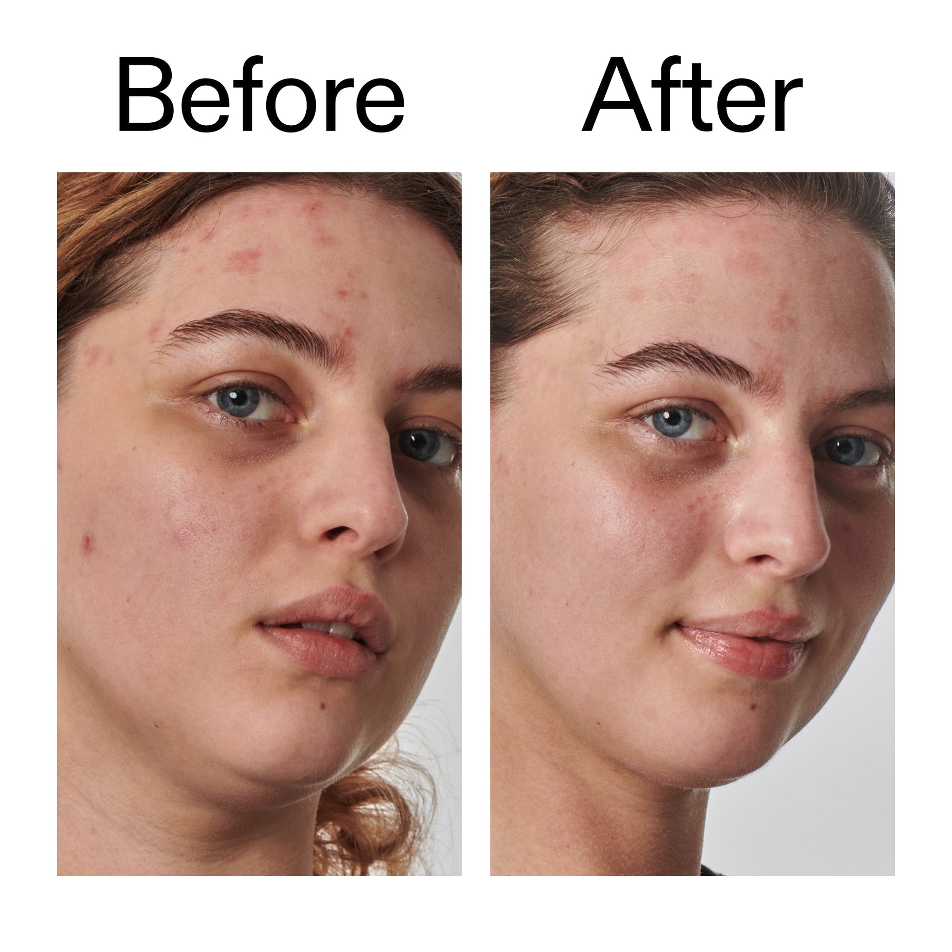 10-urea-moisturizer-i1 Dry_and_Rough_Skin_Solution_Before_After_2000x2000_efa6e639-5c39-49bd-a5dd-f0220293120a.jpg
