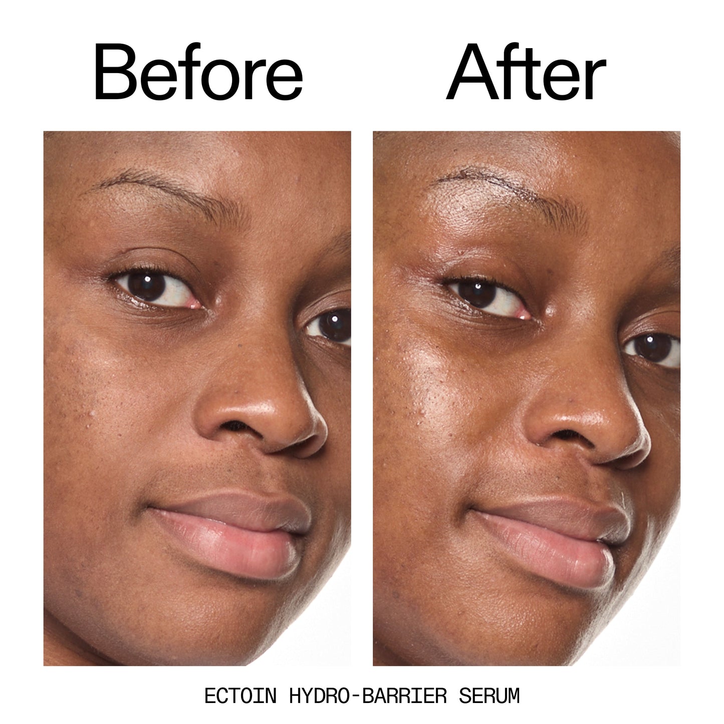 barrier-boosting-trio-k7 Ectoin_Before_After_2000x2000_ce35bc41-4da0-4b6f-adc7-29f8641f6c6c.jpg