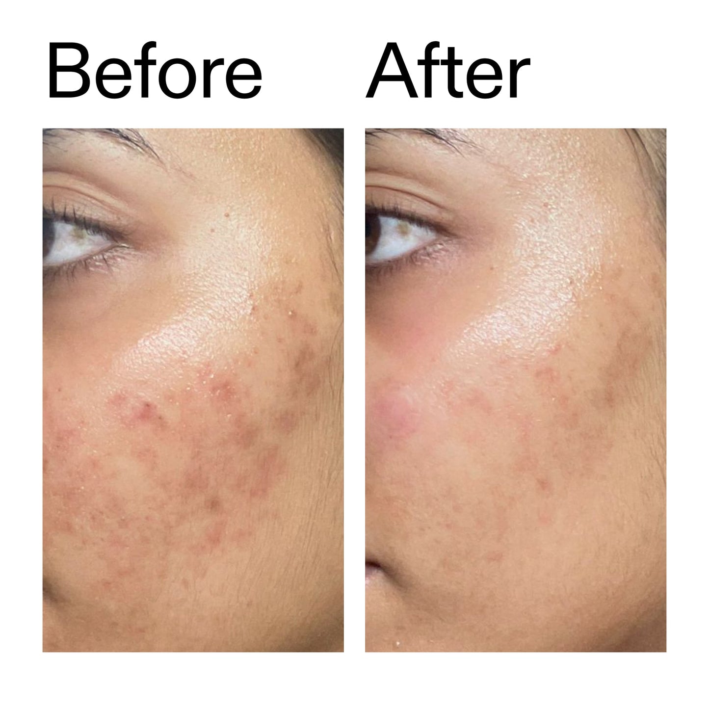 ectoin-hydro-barrier-serum-g9 Ectoin_Hydro-barrier_Serum__Before_After_2000x2000_34261920-d004-48d0-9c7b-8e1c15971bfd.jpg