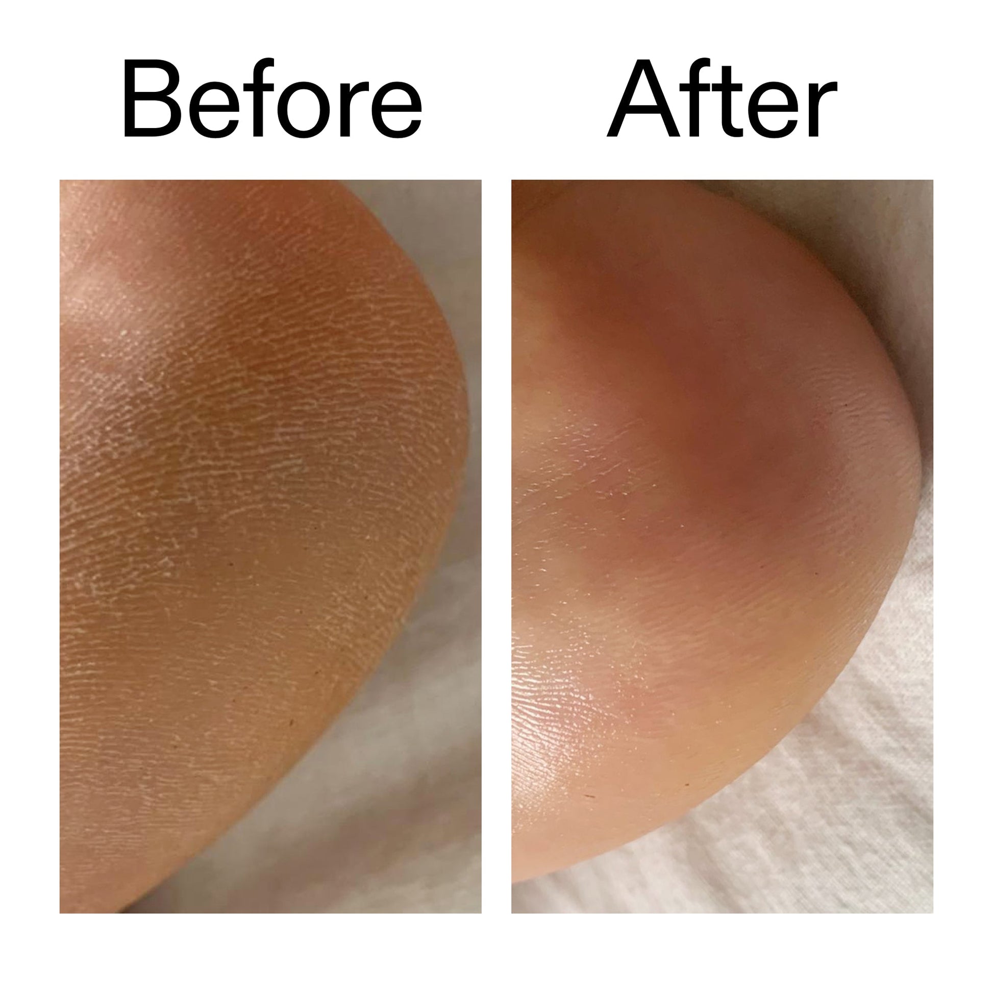 glycolic-acid-exfoliating-body-stick-duo-y2 Glycolic_Acid_Exfoliating_Body_Stick_Before_After_V1_2000x2000_a3043625-9400-429a-a7fb-d6dbd220f722.jpg