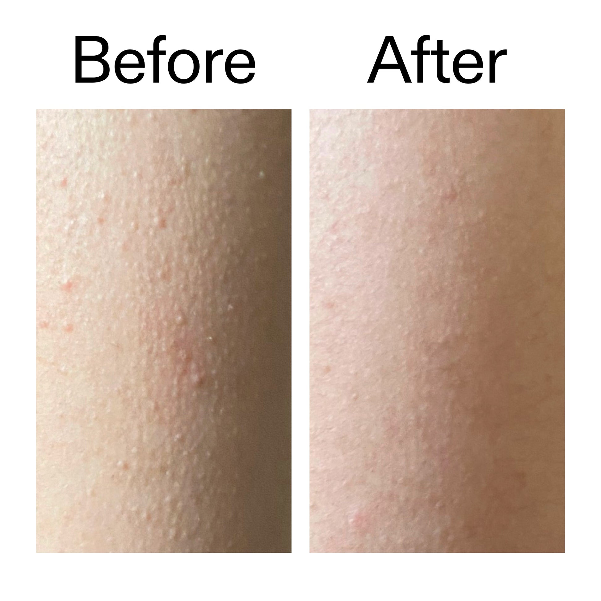 glycolic-acid-exfoliating-body-stick-x4 Glycolic_Acid_Exfoliating_Body_Stick_Before_After_V2_2000x2000_2e4ba052-94f6-4d56-82df-7bdb5b2df7ae.jpg