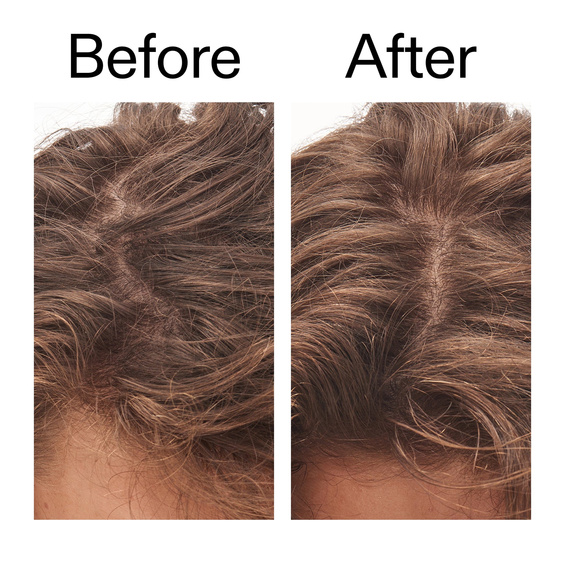 glycolic-acid-exfoliating-scalp-scrub-j0 Glycolic_Acid_Exfoliating_Scalp_Scrub_Before_After_2000x2000_b8561c87-05a1-4caa-80f7-1b6b33d750f7.jpg
