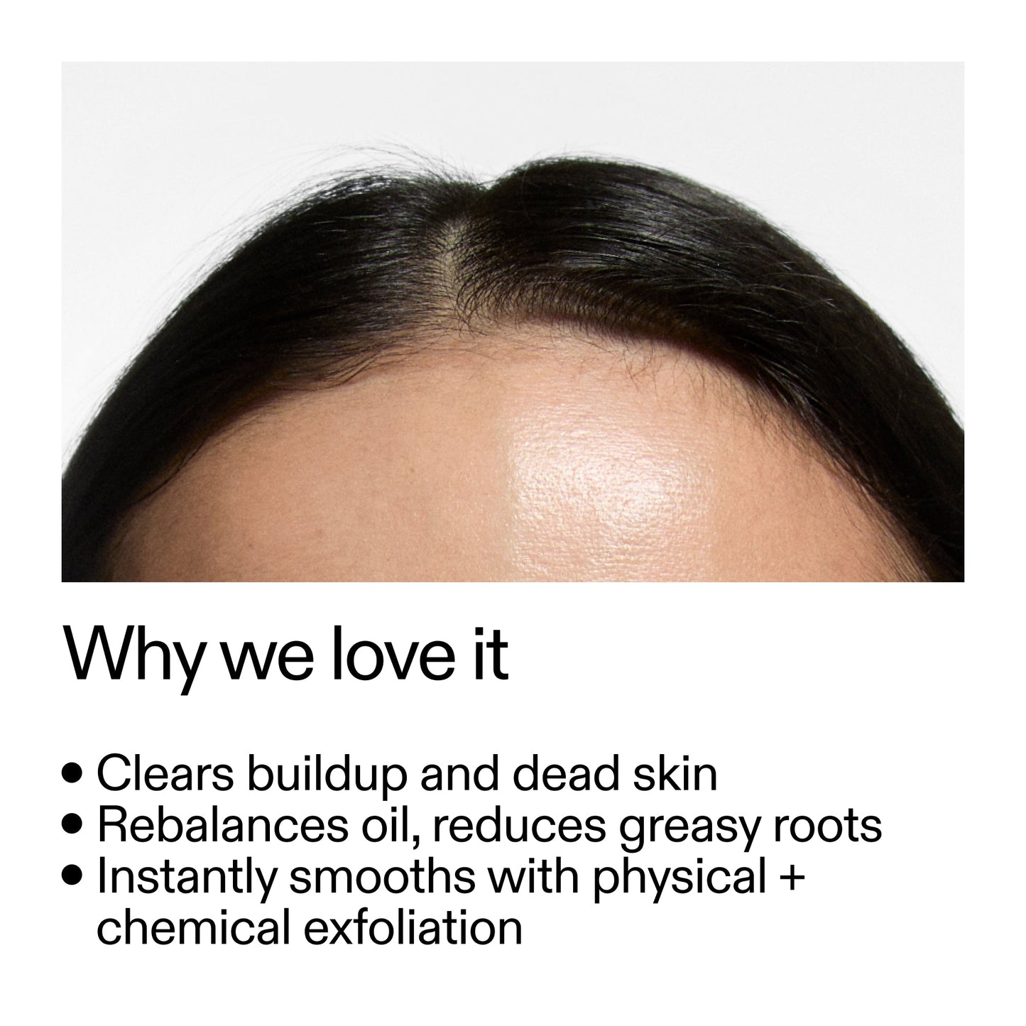 glycolic-acid-exfoliating-scalp-scrub-j0 Glycolic_Acid_Exfoliating_Scalp_Scrub_Why_we_love_it_2000x2000_46f65fb2-7d5a-4610-9788-873f5cb54602.jpg
