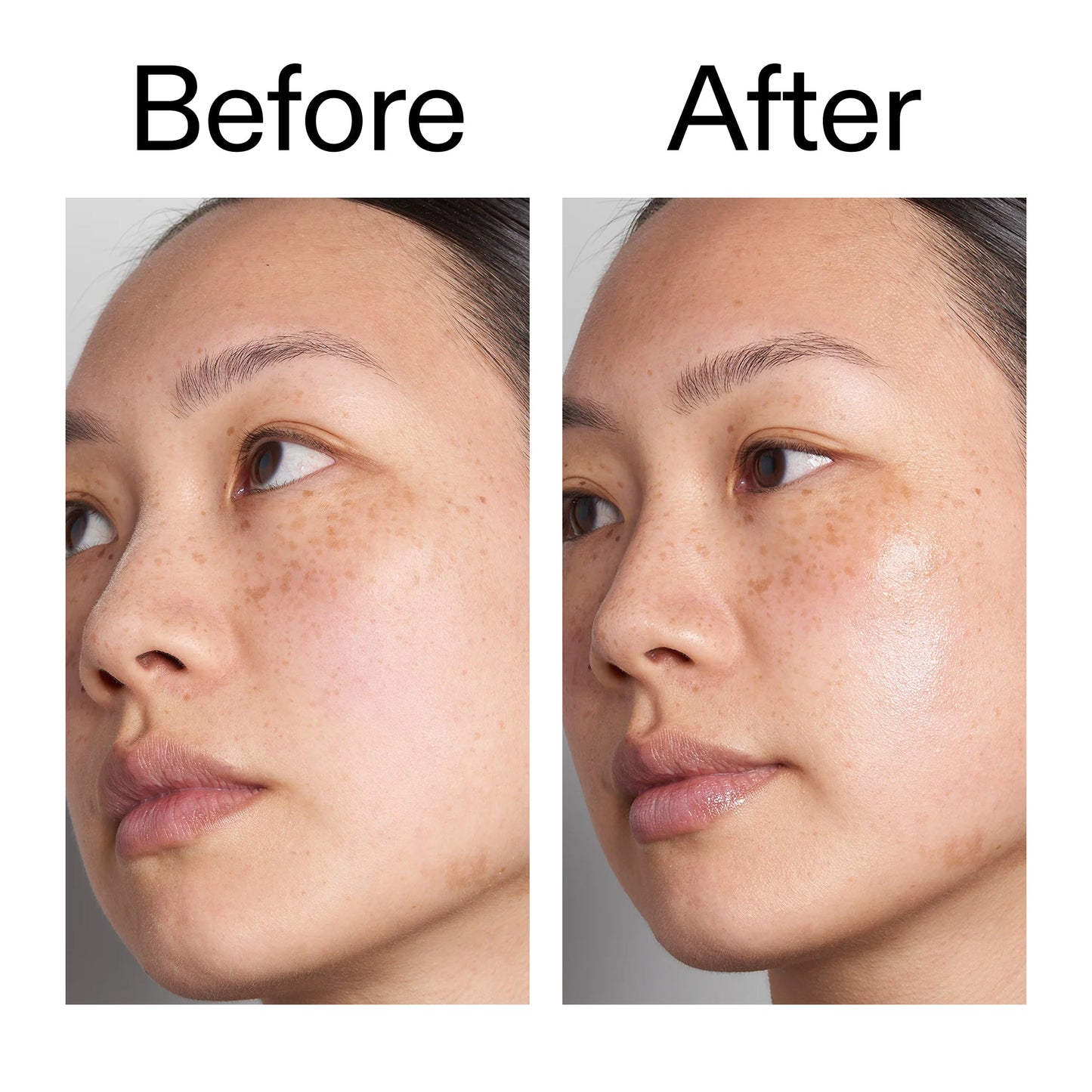 supersize-hyaluronic-acid-serum-100ml-v9 Hyaluronic_Acid_Before_After_2000x2000_d7983956-8aa2-4ea3-8255-c63e8d4f892e.jpg