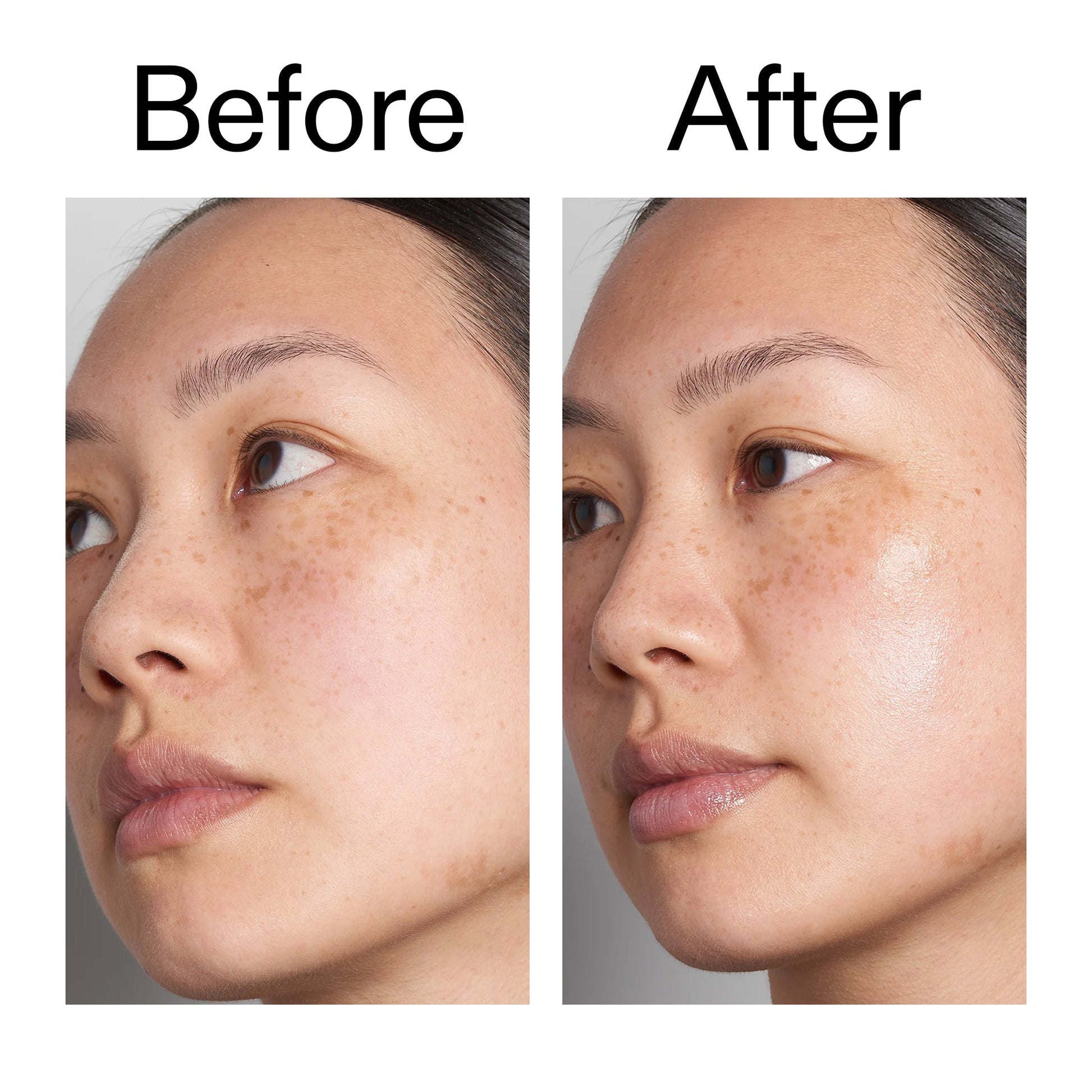 supersize-hyaluronic-acid-serum-100ml-duo-l0 Hyaluronic_Acid_Before_After_2000x2000_d7983956-8aa2-4ea3-8255-c63e8d4f892e.jpg