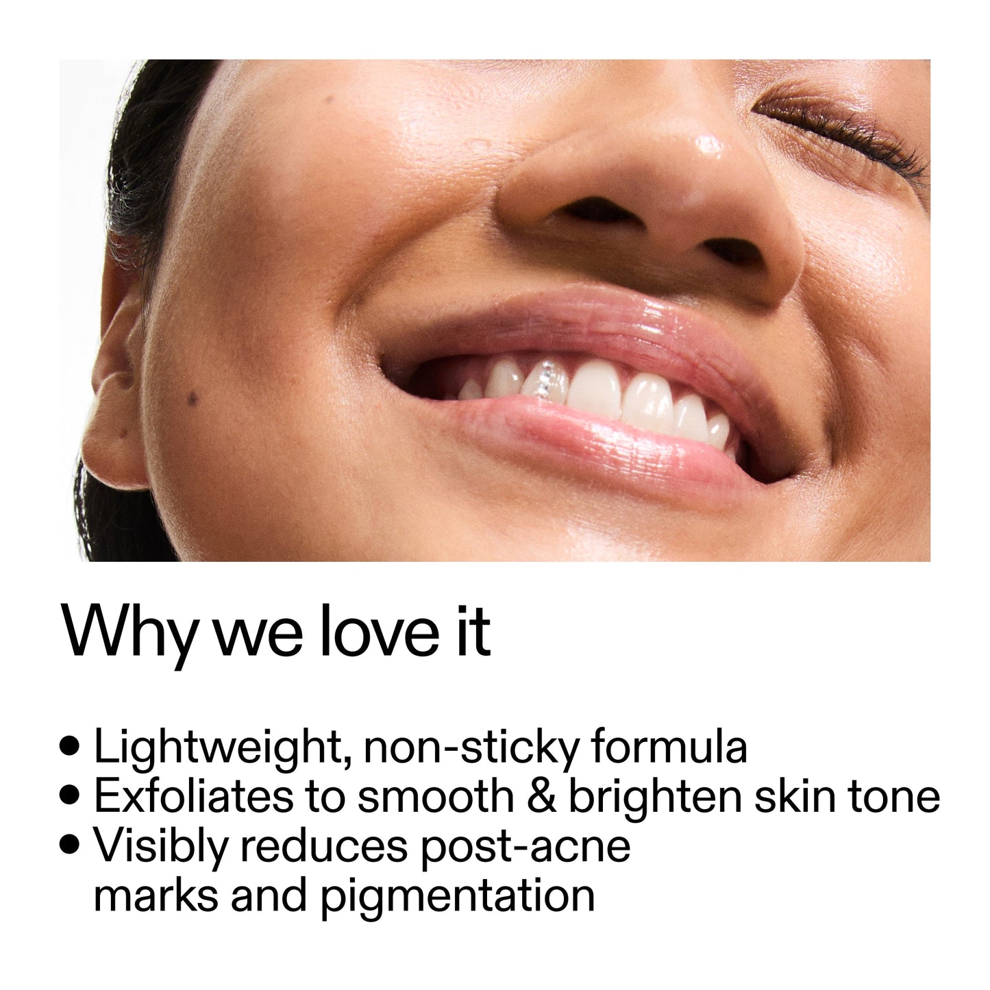 mandelic-acid-treatment-k7 Mandelic_Acid_Treatment_Why_we_love_it_2000x2000_6dfe29a9-2a79-464f-a5e8-e5ac37d93388.jpg