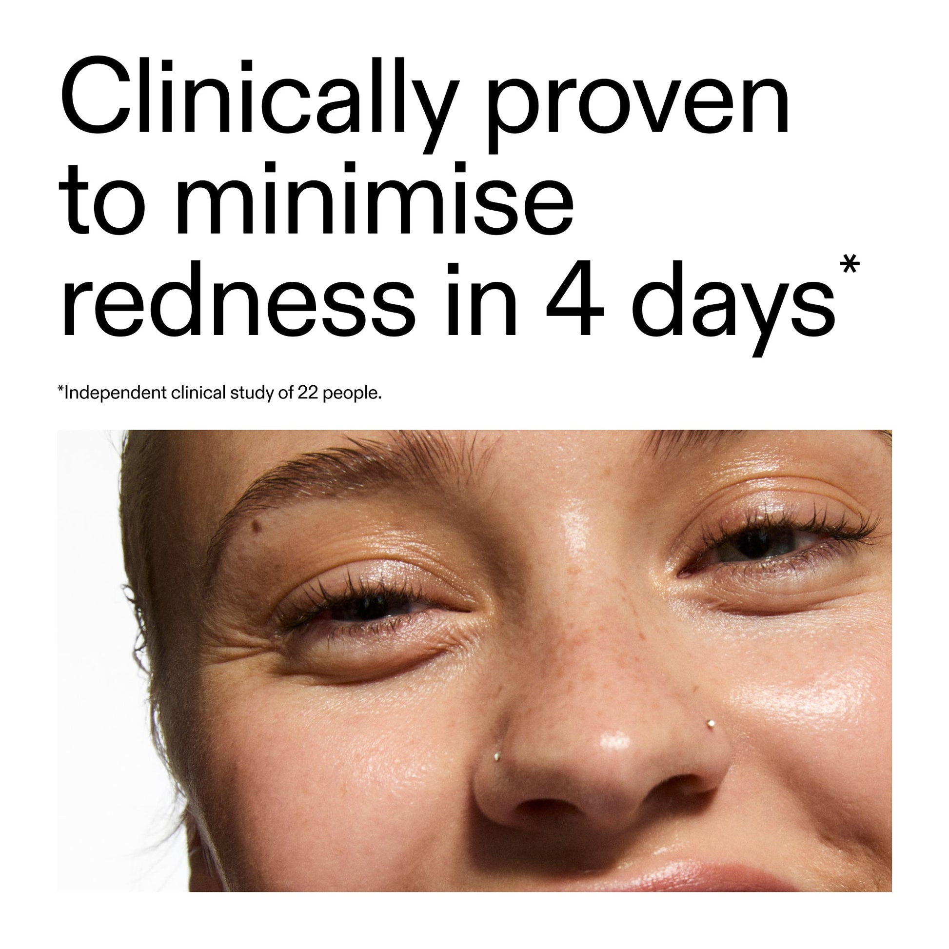 10-azelaic-acid-serum-for-redness-relief-k4 Oat_Cleansing_Balm_Claim_2000x2000_52a841dc-353c-4f2c-8646-3aadb604507d.jpg