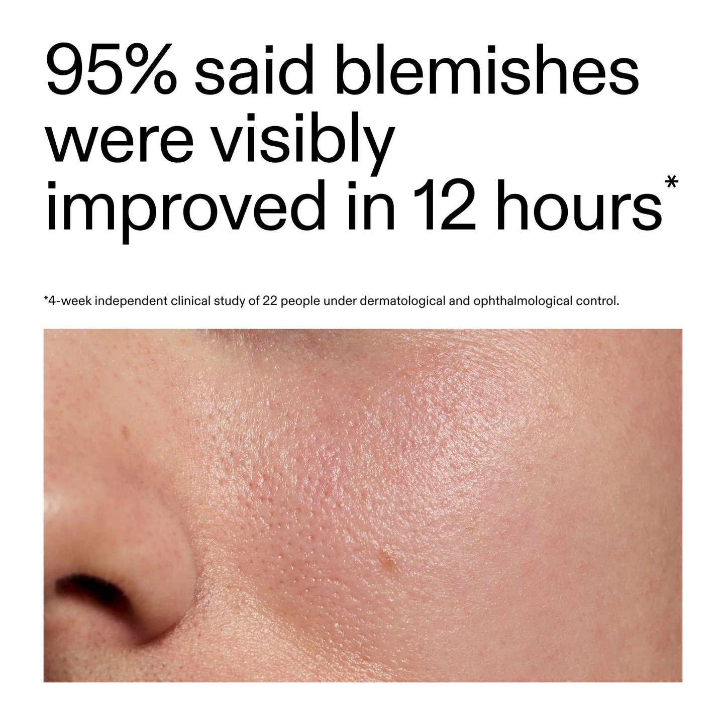 succinic-acid-acne-treatment-r0 Oat_Cleansing_Balm_Claim_2000x2000_ac6ce553-25db-41b2-a981-faae1ac4b8c0.jpg