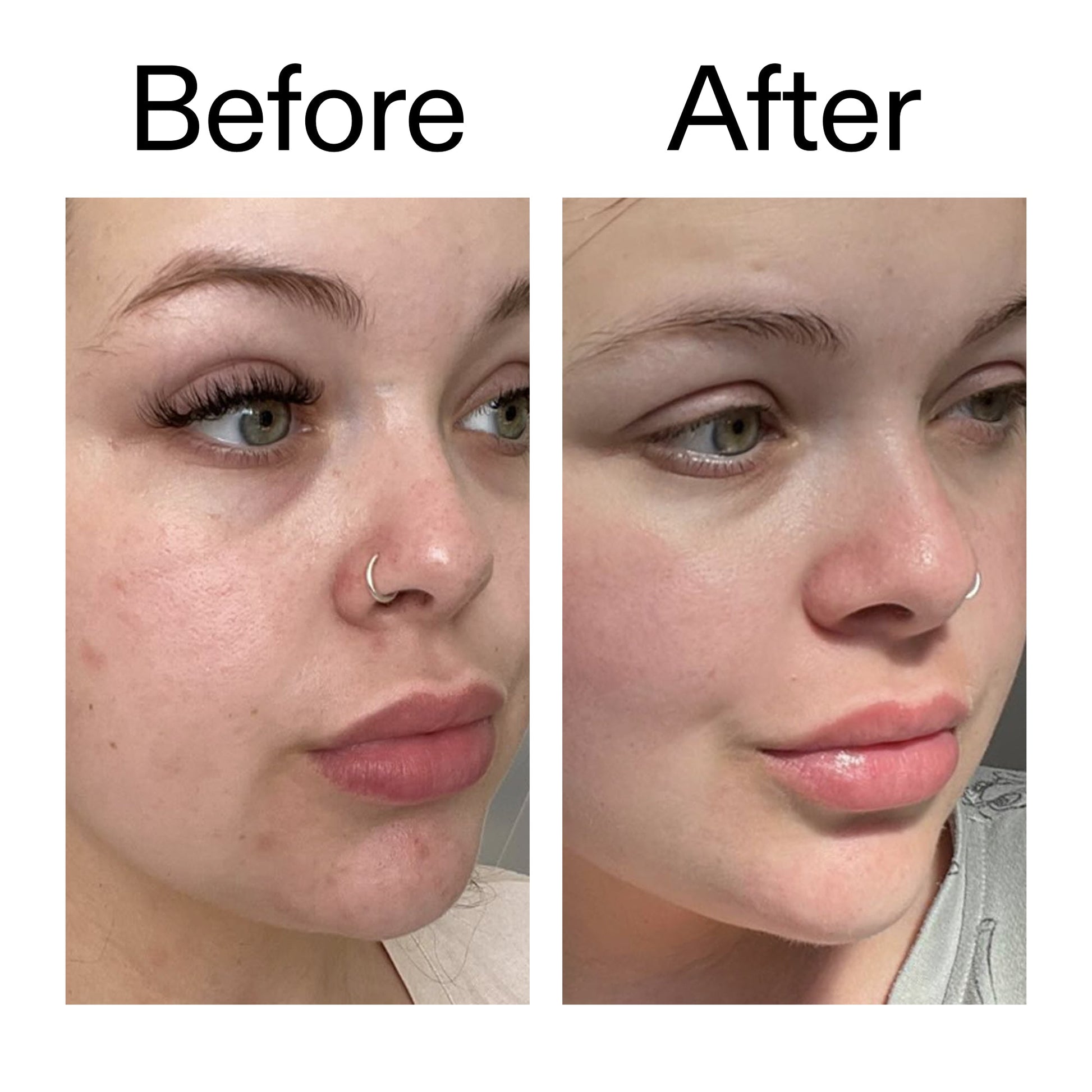 supersize-omega-water-cream-100ml-c0 Omega50_Before_After_2000x2000_46483ed8-3f9d-487f-9a0c-9df79830bd65.jpg