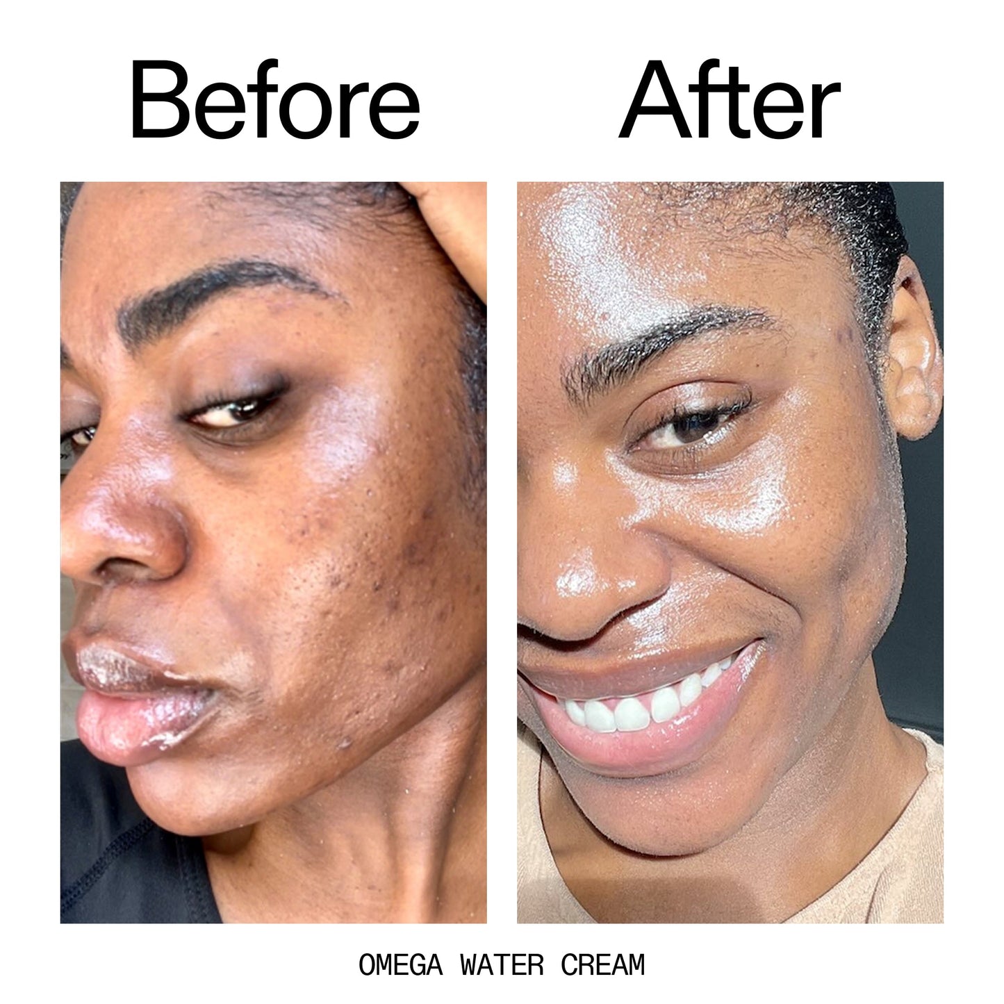 glowing-skin-set-f1 Omega_Water_Cream_Before_After_2000x2000_8e88278b-8c8d-48dc-ac77-4e98ebbd1b77.jpg