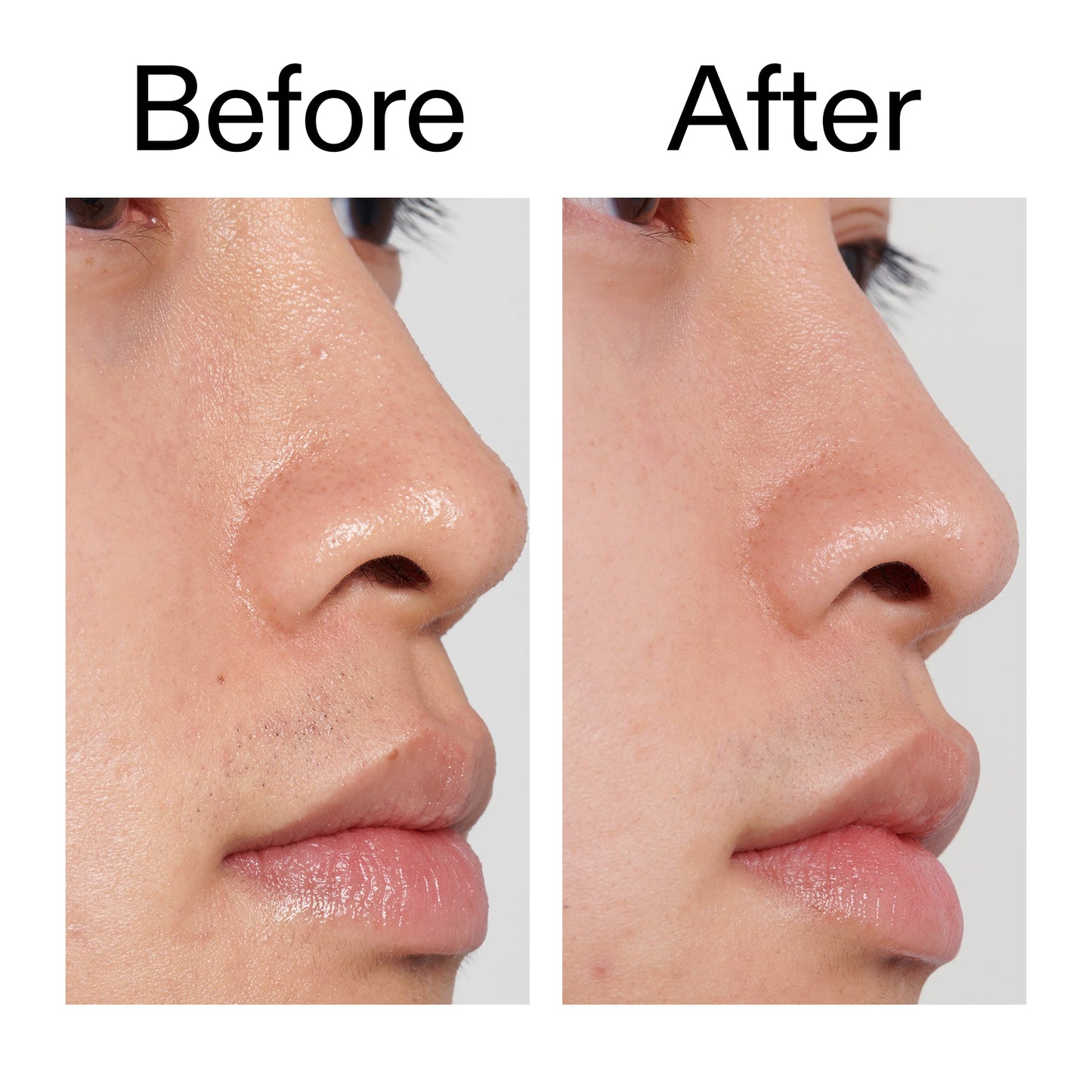 pha-toner-h8 PHA_Toner_Before_After_2000x2000_e3c10172-0150-4342-8b95-57417eaff50d.jpg