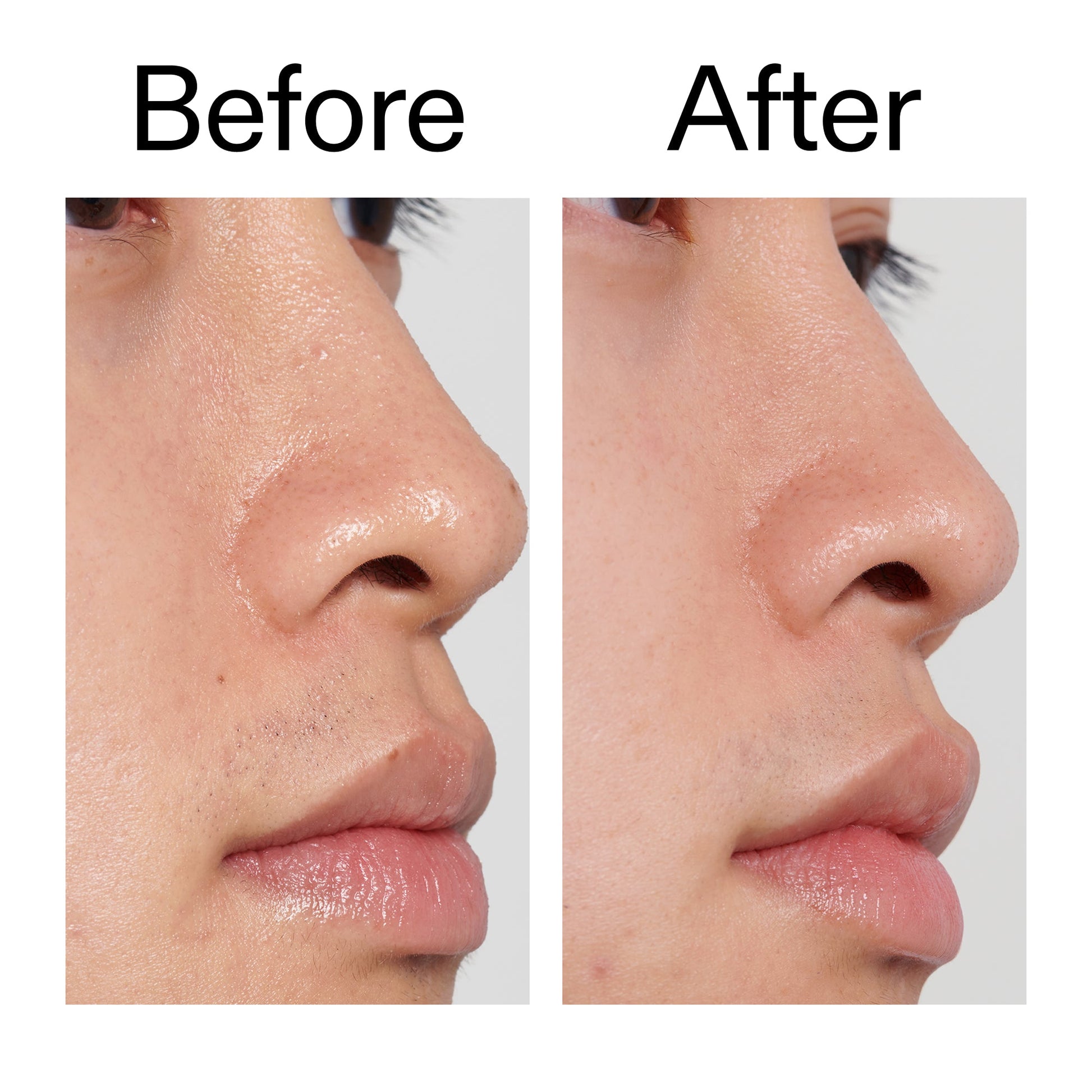 pha-toner-h8 PHA_Toner_Before_After_2000x2000_e3c10172-0150-4342-8b95-57417eaff50d.jpg