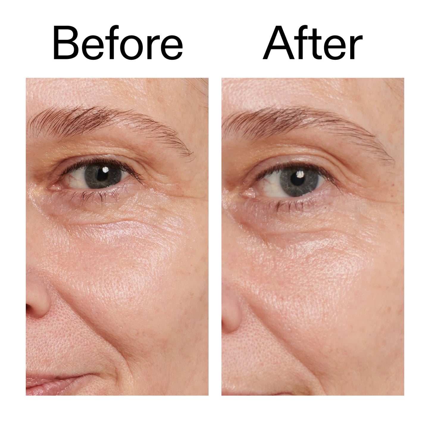 retinol-eye-cream-g1 Retinol_Eye_Cream_Before_After_2000x2000_ac03a80c-109e-4572-a95a-91dc109b4d27.jpg