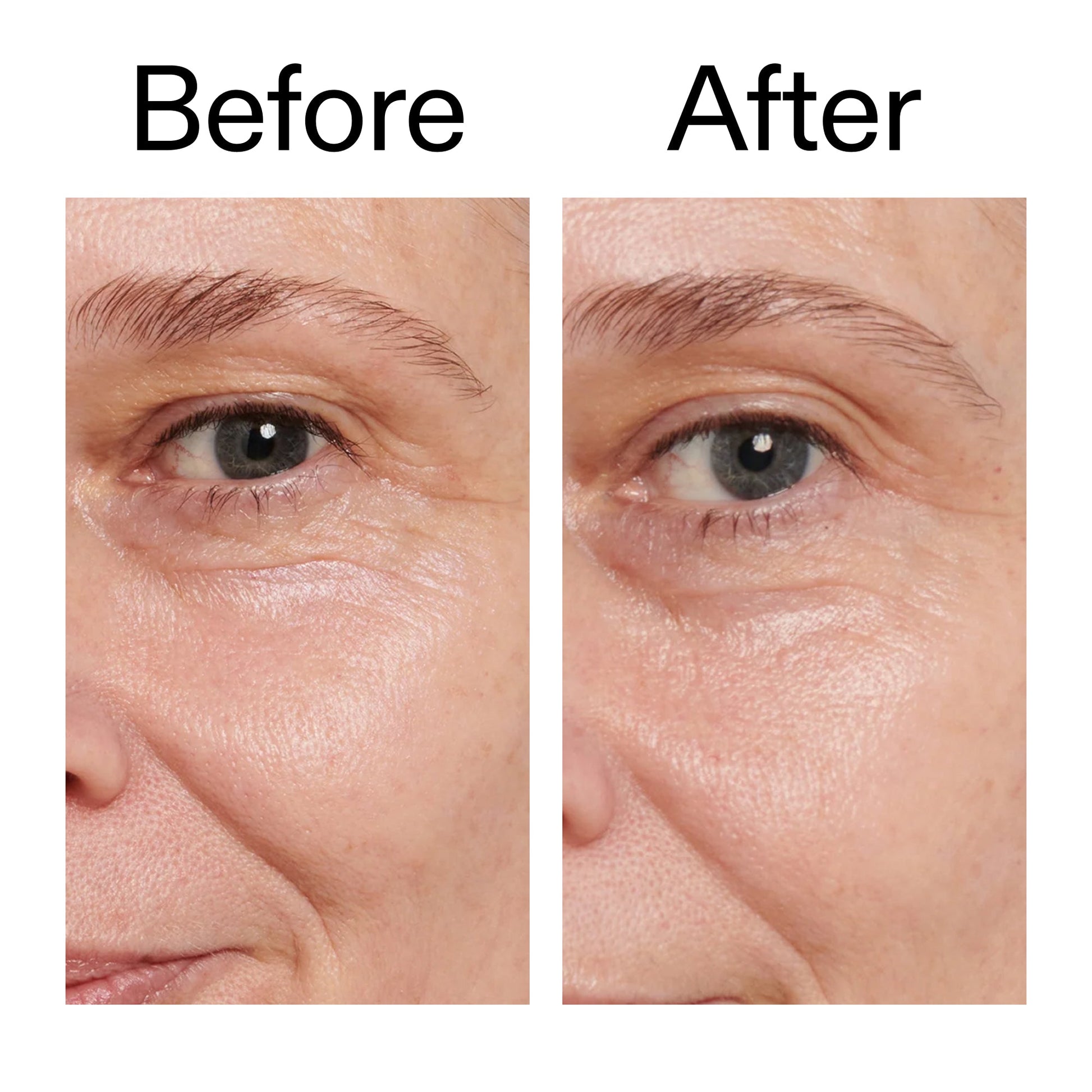 retinol-eye-cream-g1 Retinol_Eye_Cream_Before_After_2000x2000_ac03a80c-109e-4572-a95a-91dc109b4d27.jpg
