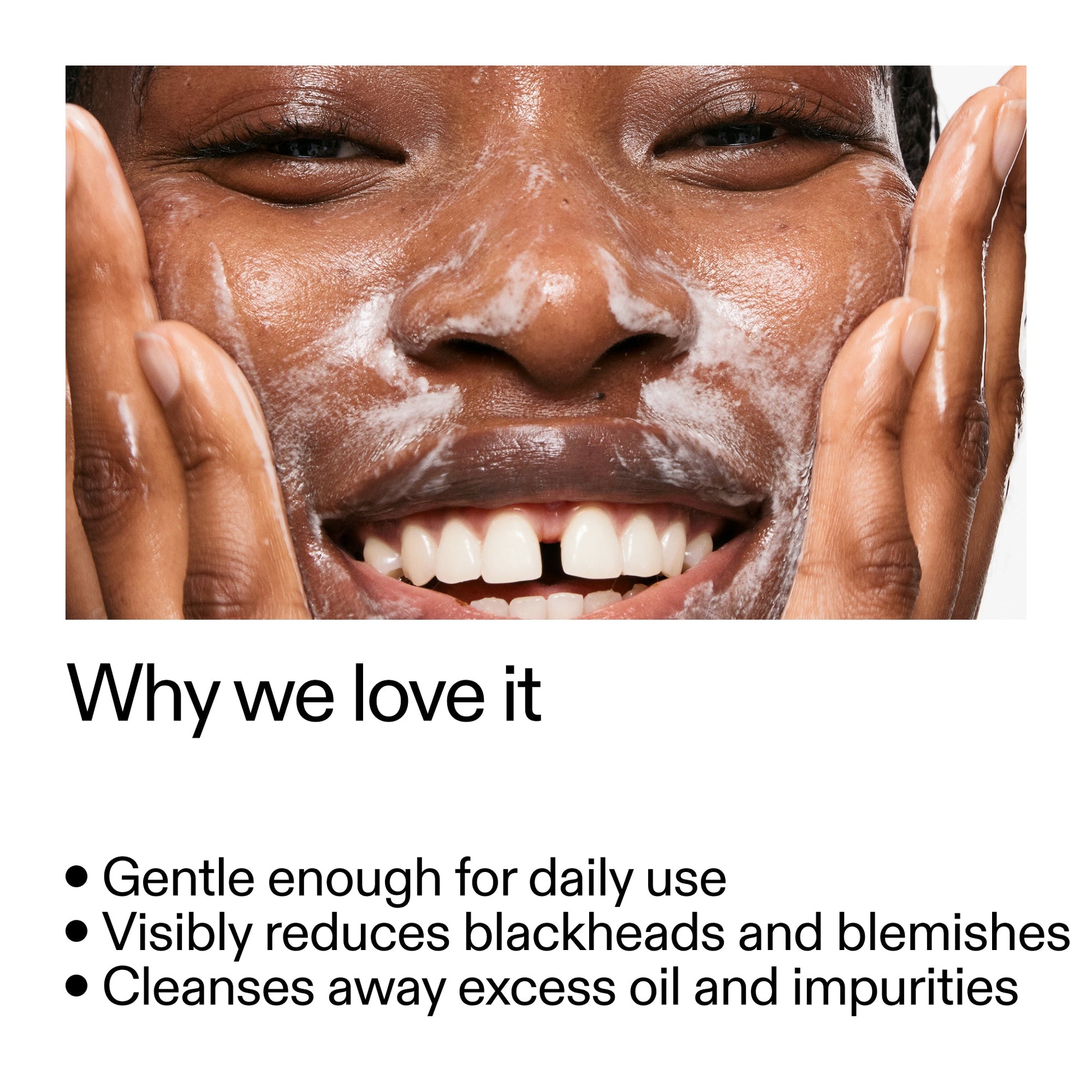 salicylic-acid-cleanser-duo-u5 Salicylic_Acid_Cleanser_-_300mlWhy_we_love_it_2000x2000_87dc92a9-2559-4309-98cd-4e570f1be735.jpg