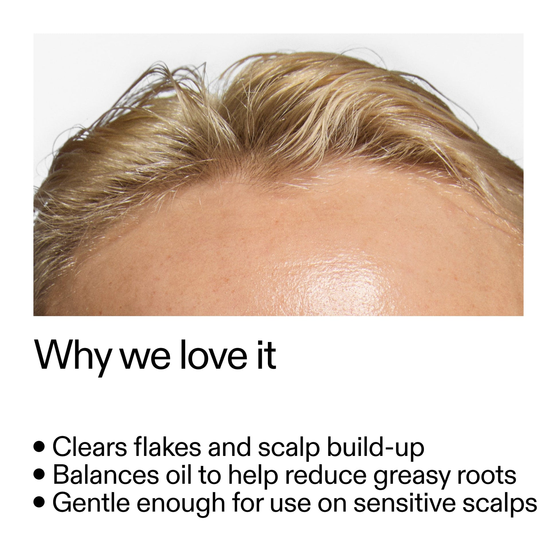salicylic-acid-exfoliating-scalp-treatment-b5 Salicylic_Acid_Exfoliating_Scalp_Treatment_Why_we_love_it_2000x2000_44b6bd6d-9ec4-4b23-9dc4-bc3fd6f28e14.jpg
