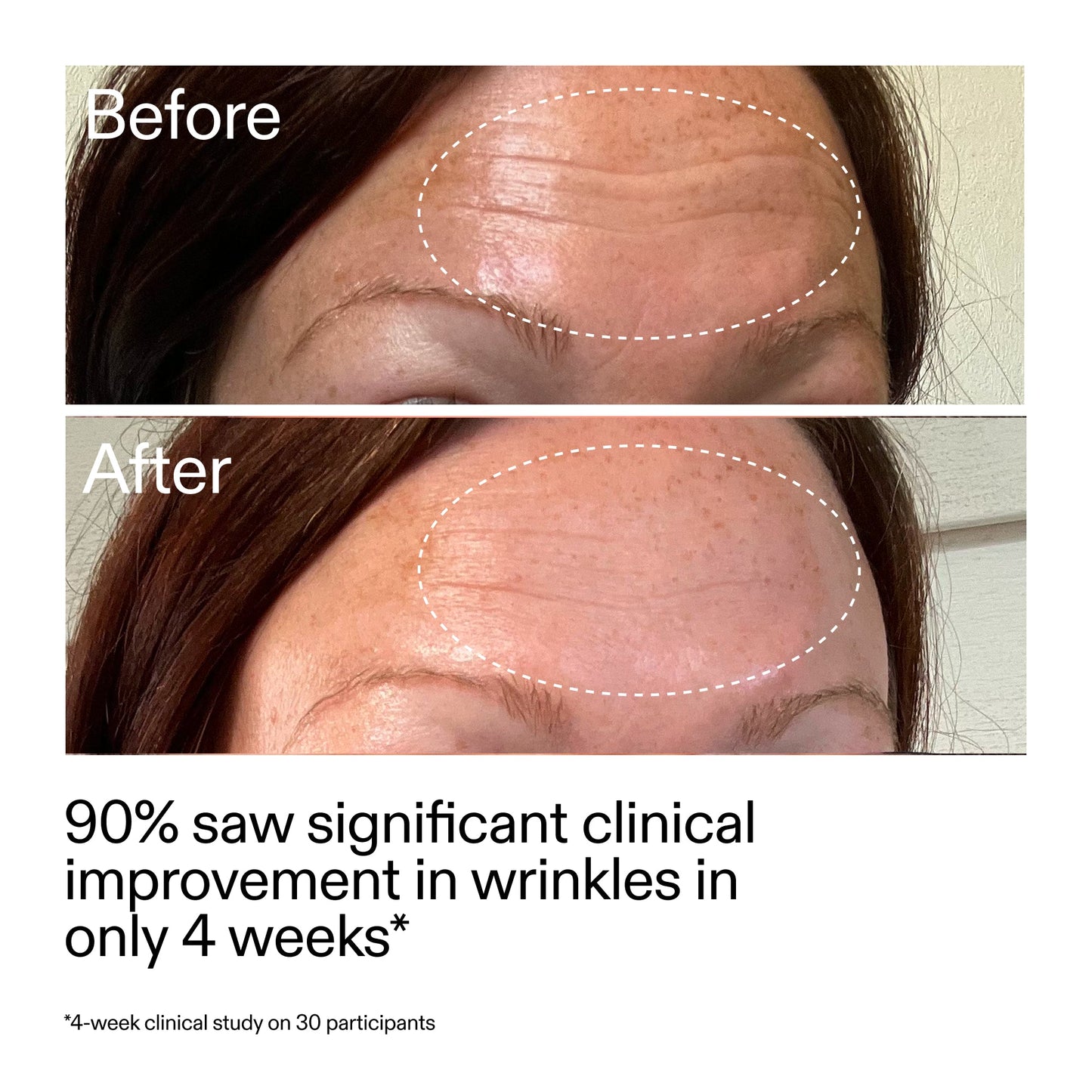 starter-retinol-serum-q6 StarterRetinol_BeforeAfter_Claim1_2000x2000_a09b50b6-4688-4527-abae-21bd142b89b7.jpg