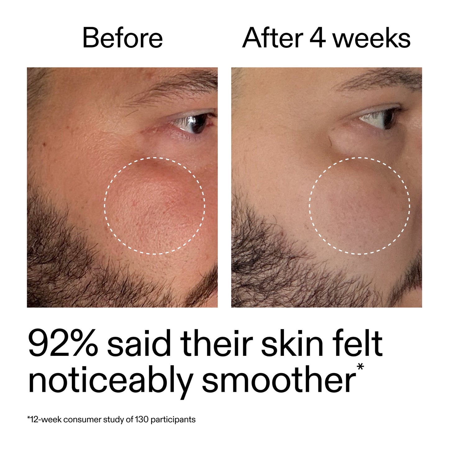 starter-retinol-serum-q6 StarterRetinol_BeforeAfter_Claim3_2000x2000_6ceab106-e0ee-4ed4-ba62-41bc39538038.jpg