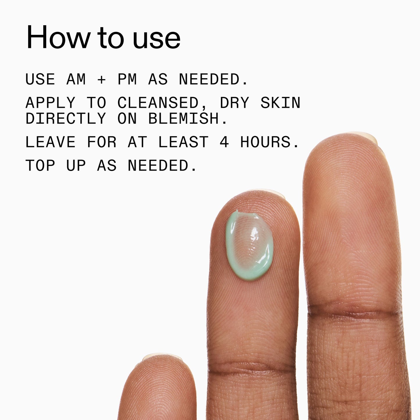 succinic-acid-acne-treatment-r0 Succinic_Acid_Treatment_How_to_Use_2000x2000_d57137d5-d7f1-427c-9a46-5fc00c19c542.jpg