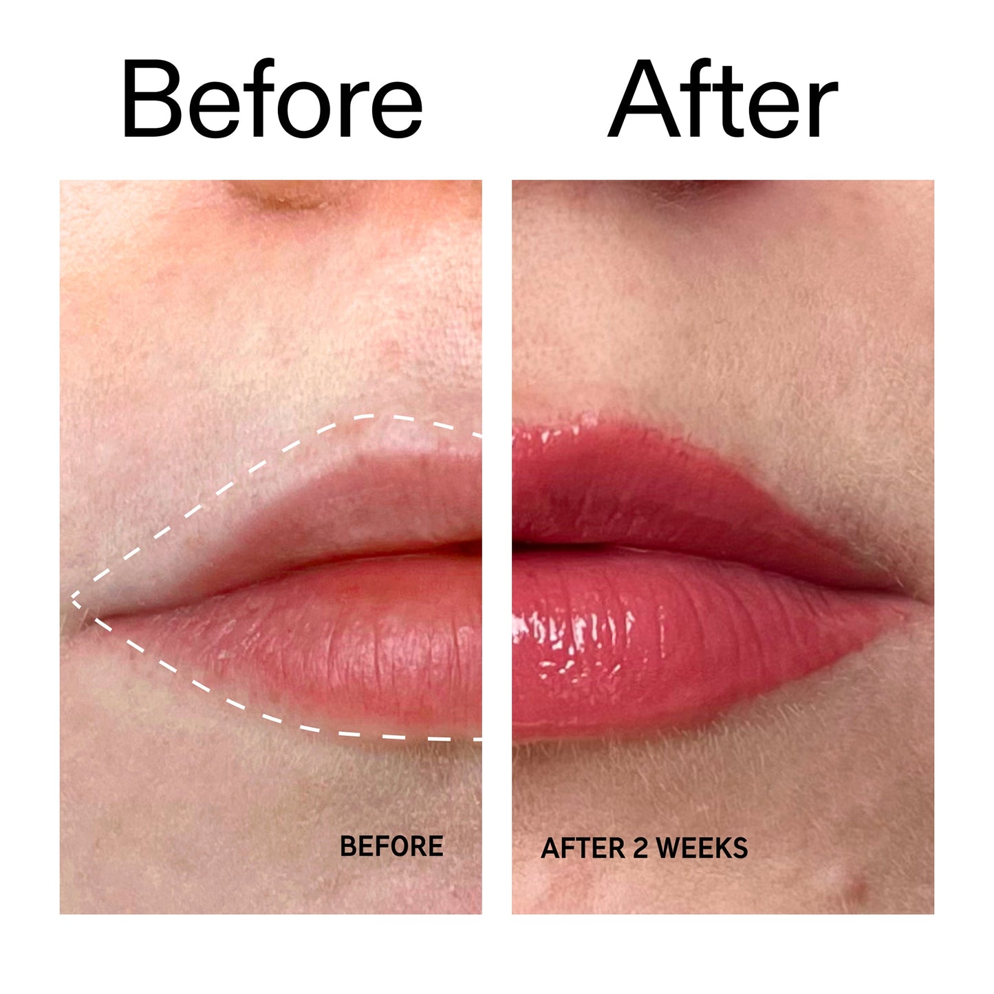 tripeptide-plumping-berry-lip-balm-b6 Tripeptide_Plumping_Lip_Balm_-_Berry_Before_After_2000x2000_9474bbd8-43ca-4b0e-b0e7-dfab70b91927.jpg