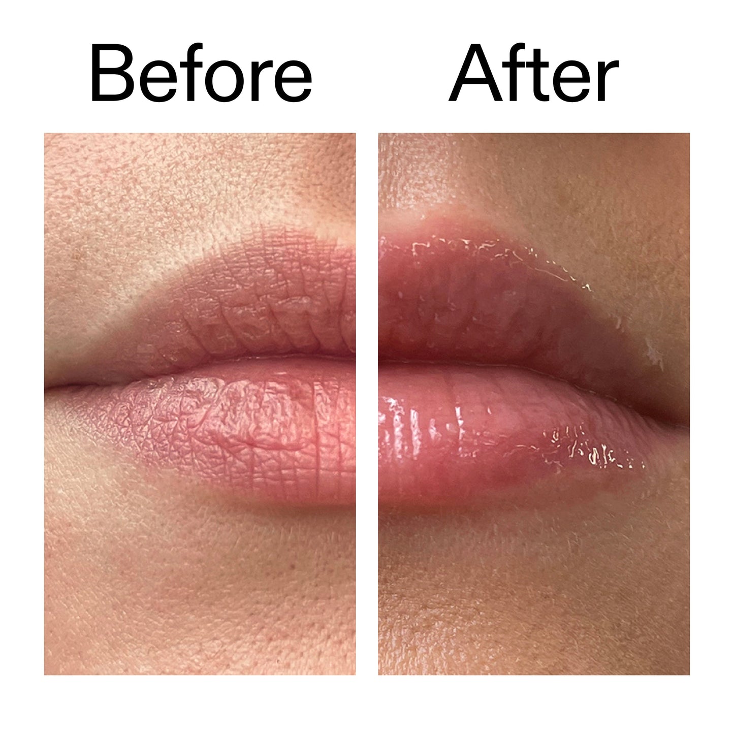 tripeptide-plumping-lip-balm-q8 Tripeptide_Plumping_Lip_Balm_Before_After_2000x2000_b4a5ee04-d2ac-4857-8f01-17209acc4bf3.jpg