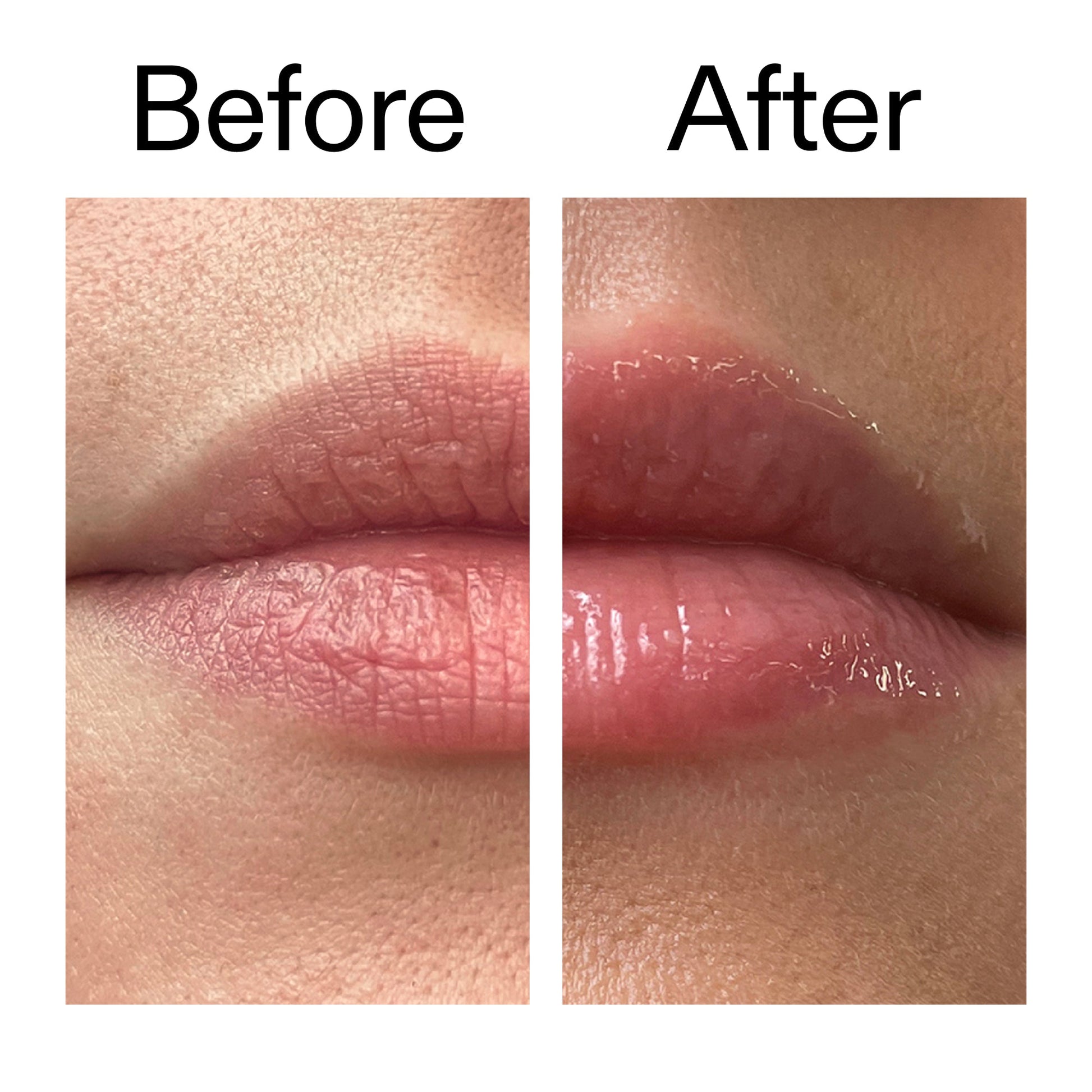 lip-plumping-duo-r7 Tripeptide_Plumping_Lip_Balm_Before_After_2000x2000_b4a5ee04-d2ac-4857-8f01-17209acc4bf3.jpg