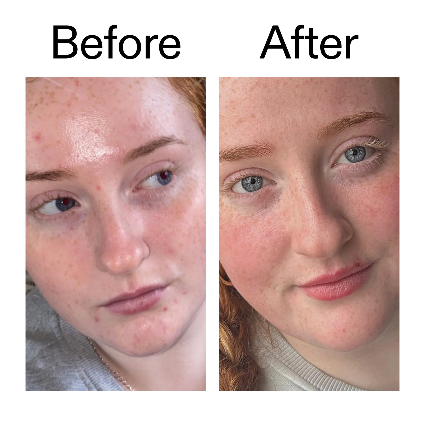 vitamin-b-c-and-e-moisturizer-s4 Vitamin_B_C_and_E_Moisturizer_Before_After_2000x2000_b0781a76-5ad2-4be9-95b8-ef92b356833c.jpg